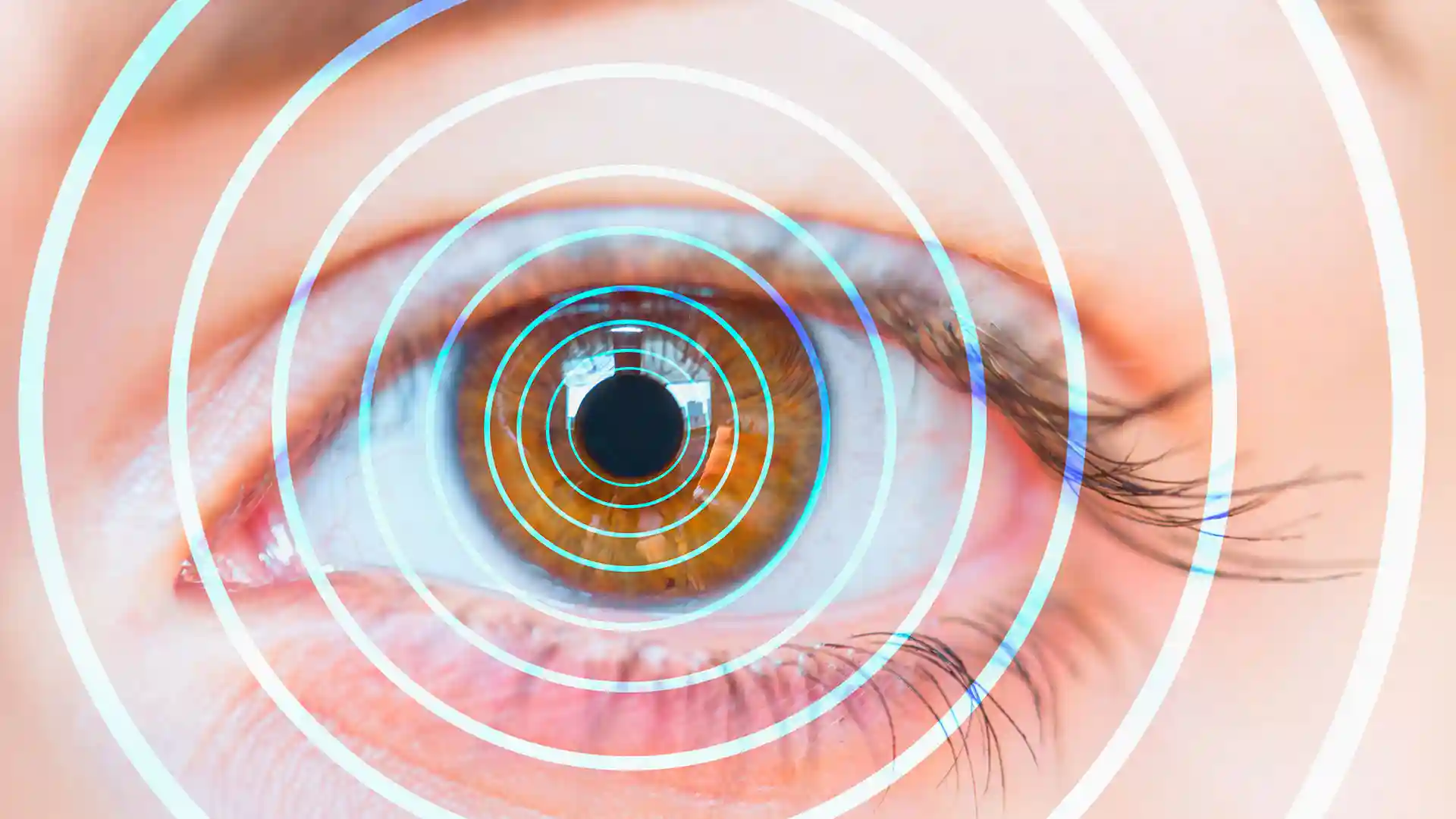 Hypnose