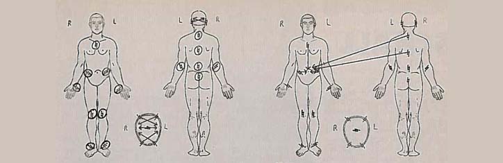 Schalltherapie erfolgreich bei Legasthenie