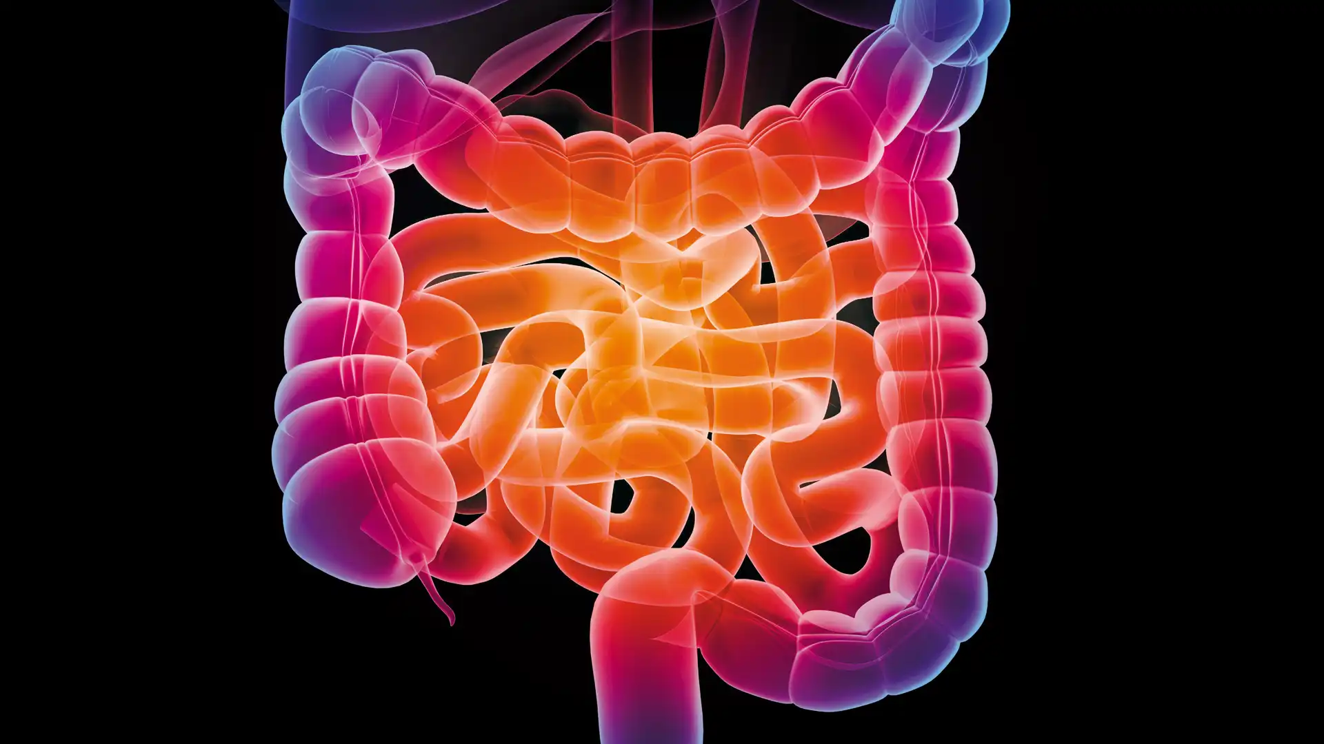 Colitis ulcerosa und Morbus Crohn